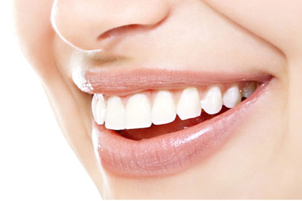dental-bonding-anderson dental bonding anderson