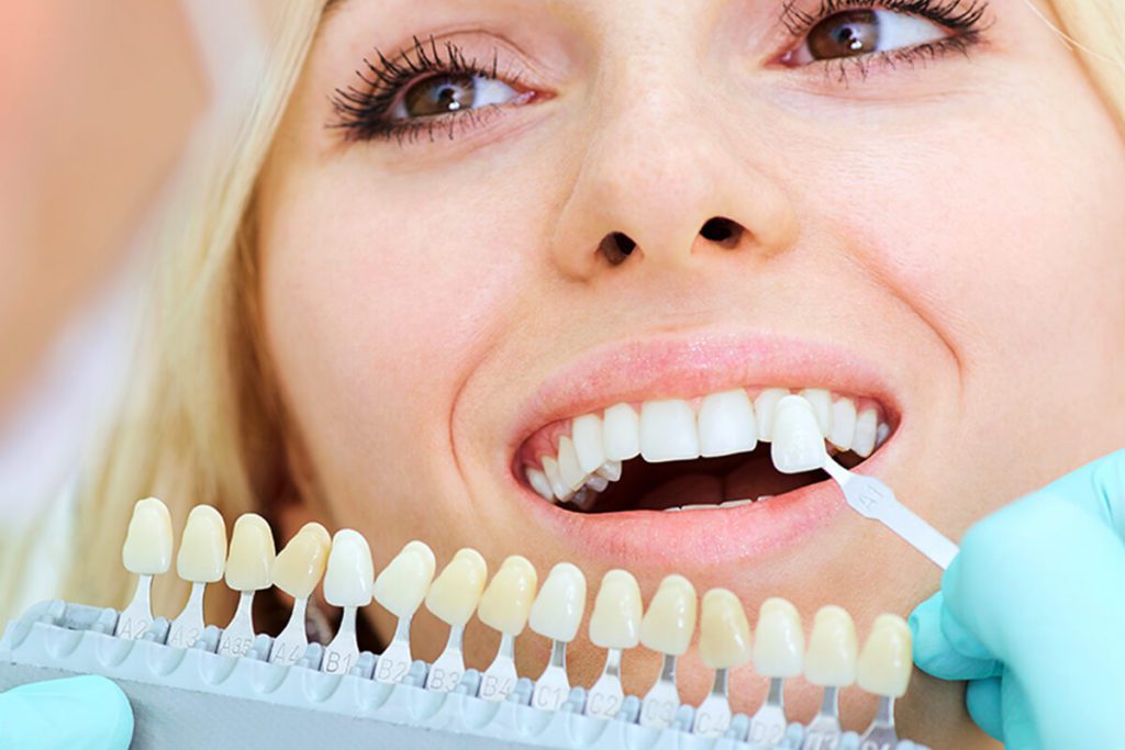tooth-colored-fillings-anderson tooth colored fillings anderson