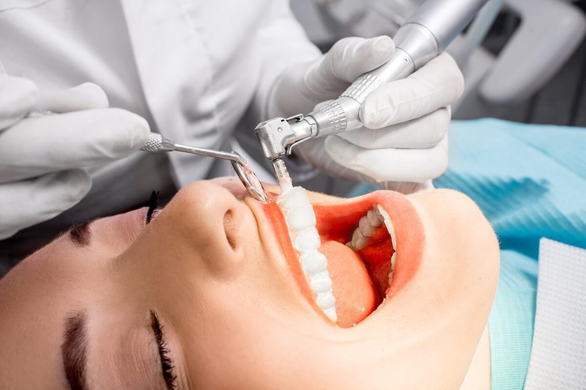 What is a Prophylaxis? Advanced Dental Care of Anderson