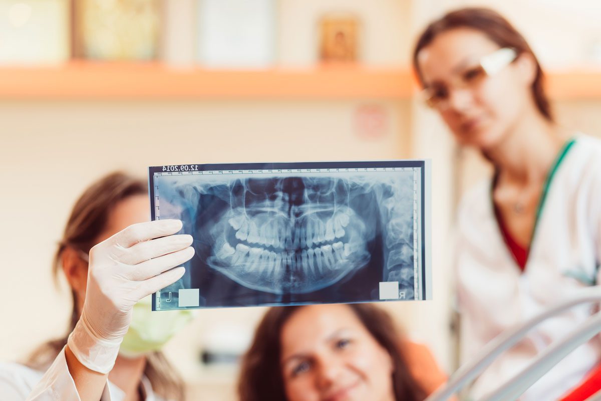 dental x rays anderson digital x rays anderson