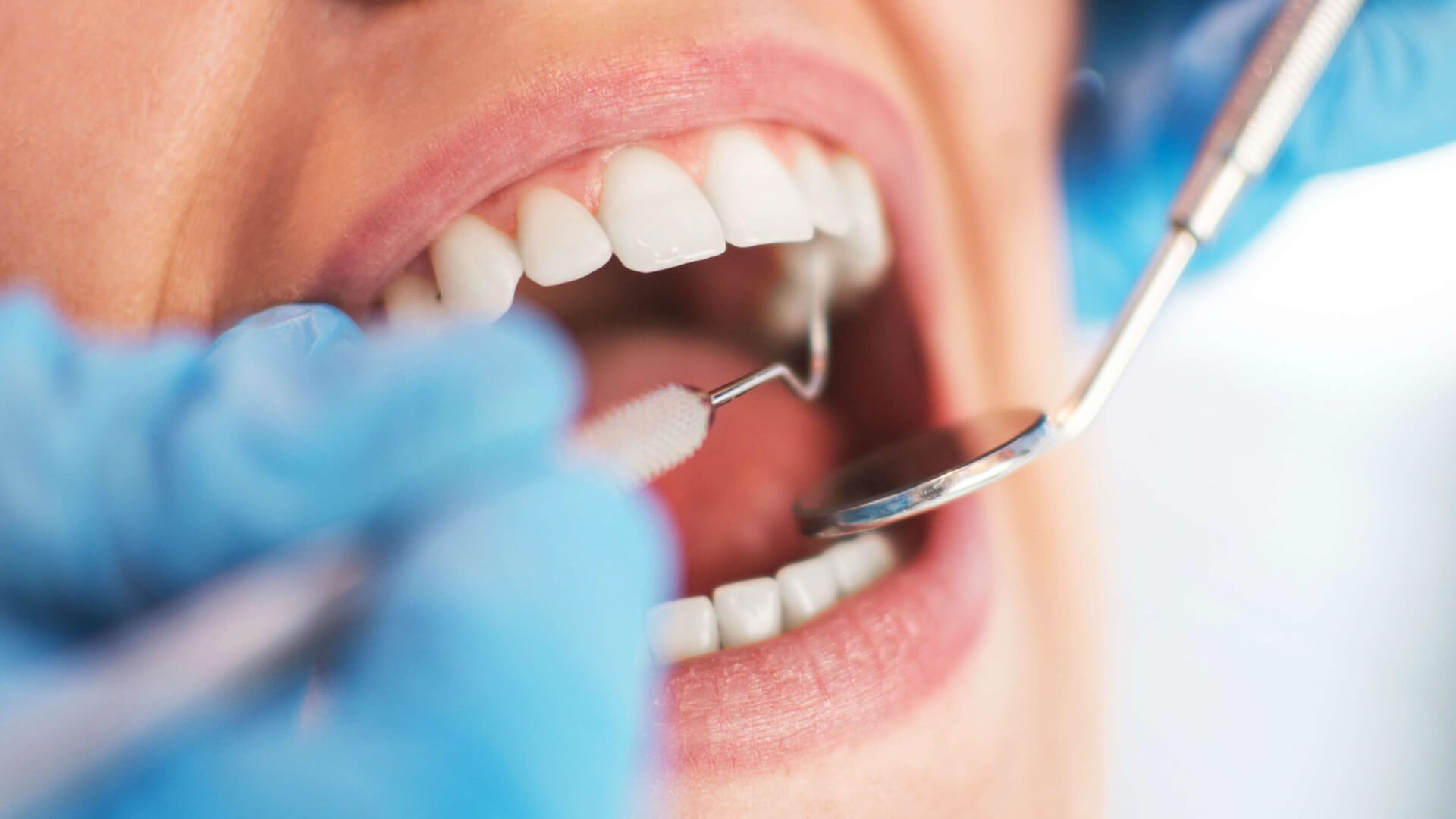 What Is A Root Canal Advanced Dental Care Of Anderson